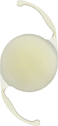 Vivity extended focus lens implant